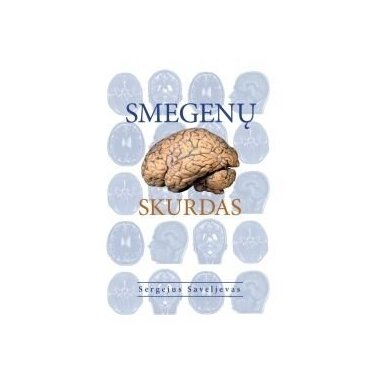 Smegenų skurdas